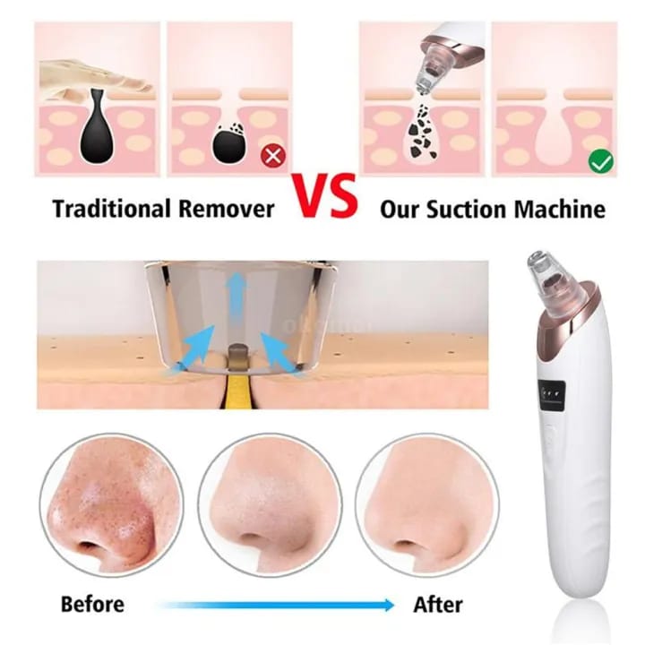 Face Vacuum Suction Blackhead Remover Pore Cleaner | Electric Deep Cleansing & Skin Care Tool